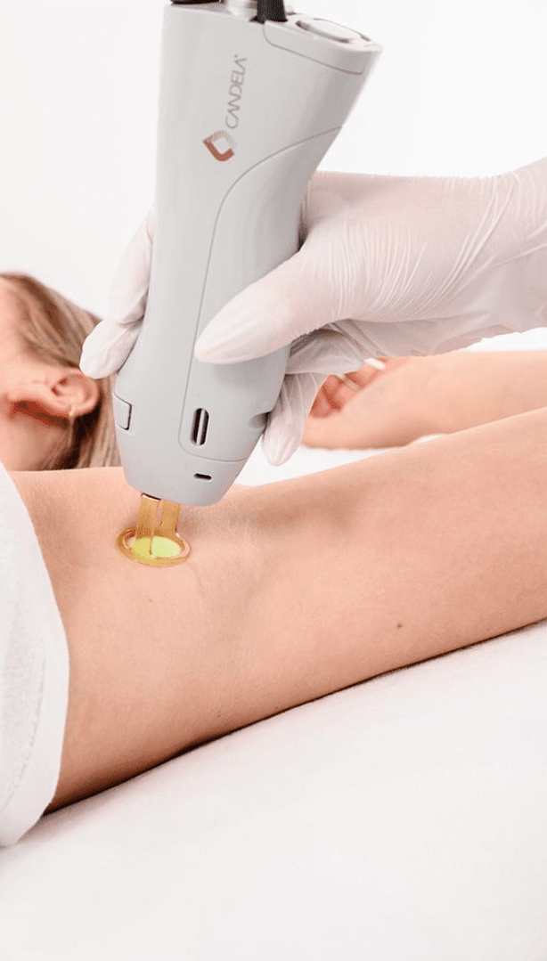 Doet laserontharing pijn? Het comfort van de GentleMax Pro Plus uitgelegd - 2